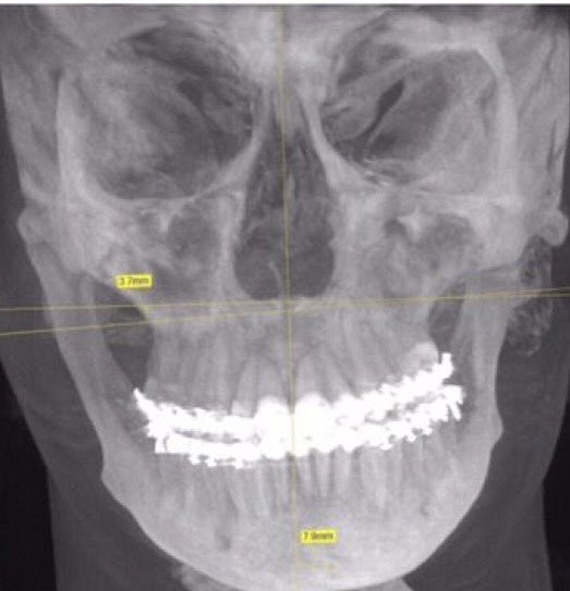 Alfred 🏄🏻‍♀️🌊 tweet media