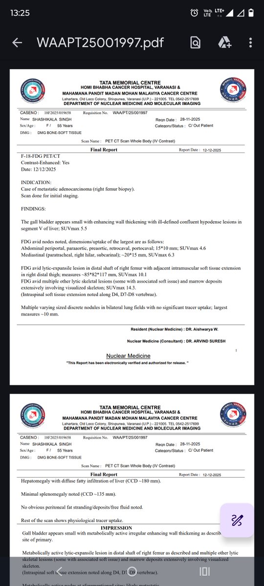 thethakurforce's tweet image. जौनपुर (उत्तर प्रदेश) के एक किसान परिवार से आने वाली, ग्रामीण परिवेश में जीवन व्यतीत कर रही 55 वर्षीय शशिकला सिंह जी के जीवन पर उस समय मानो पहाड़ टूट पड़ा, जब उन्हें कैंसर जैसी गंभीर बीमारी का पता चला। यह खबर पूरे परिवार के लिए गहरा आघात बनकर आई।

वर्तमान में उनका उपचार वाराणसी…