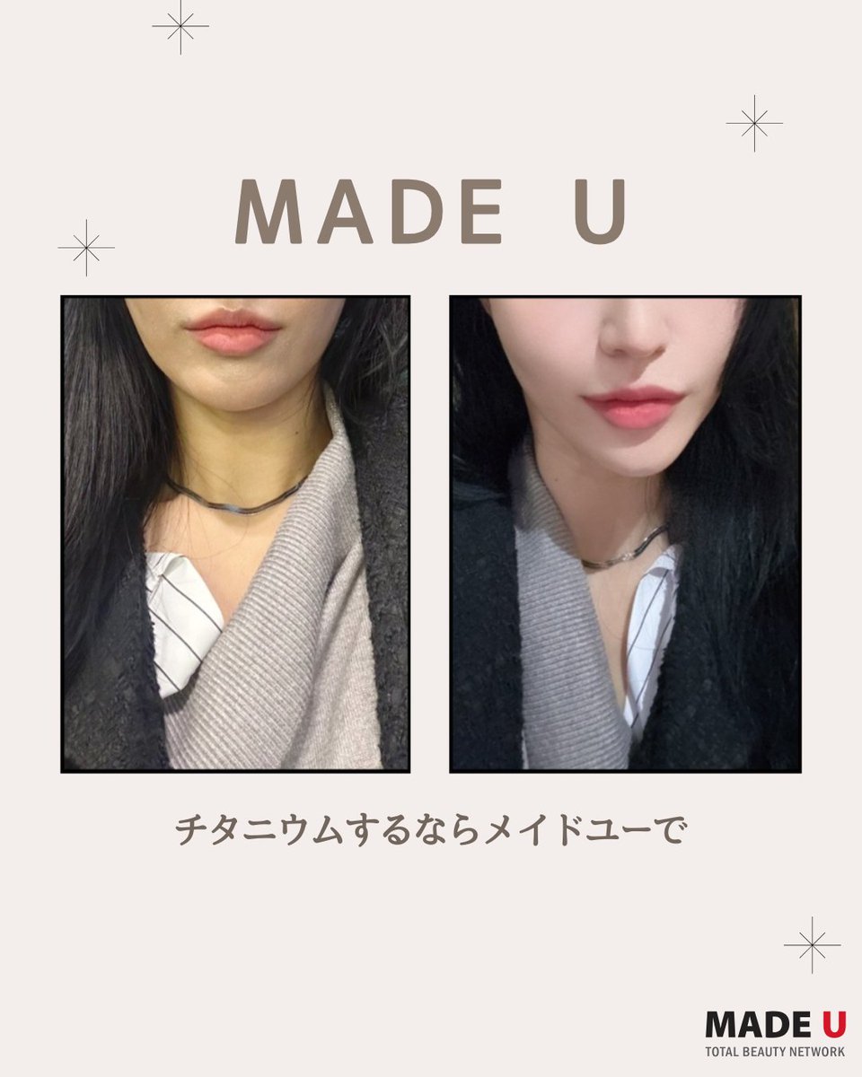 メイドユー医院 (@madeujp) / Posts / X