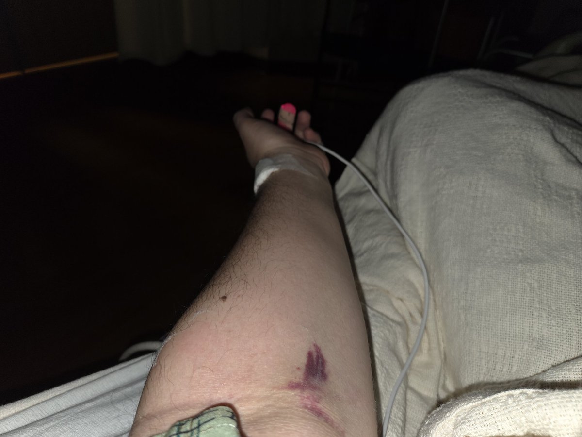 Kaze_Silver's tweet photo. 2AM vampires! My arm has not liked all the draws for the lab. https://t.co/WY4GHga3Zo