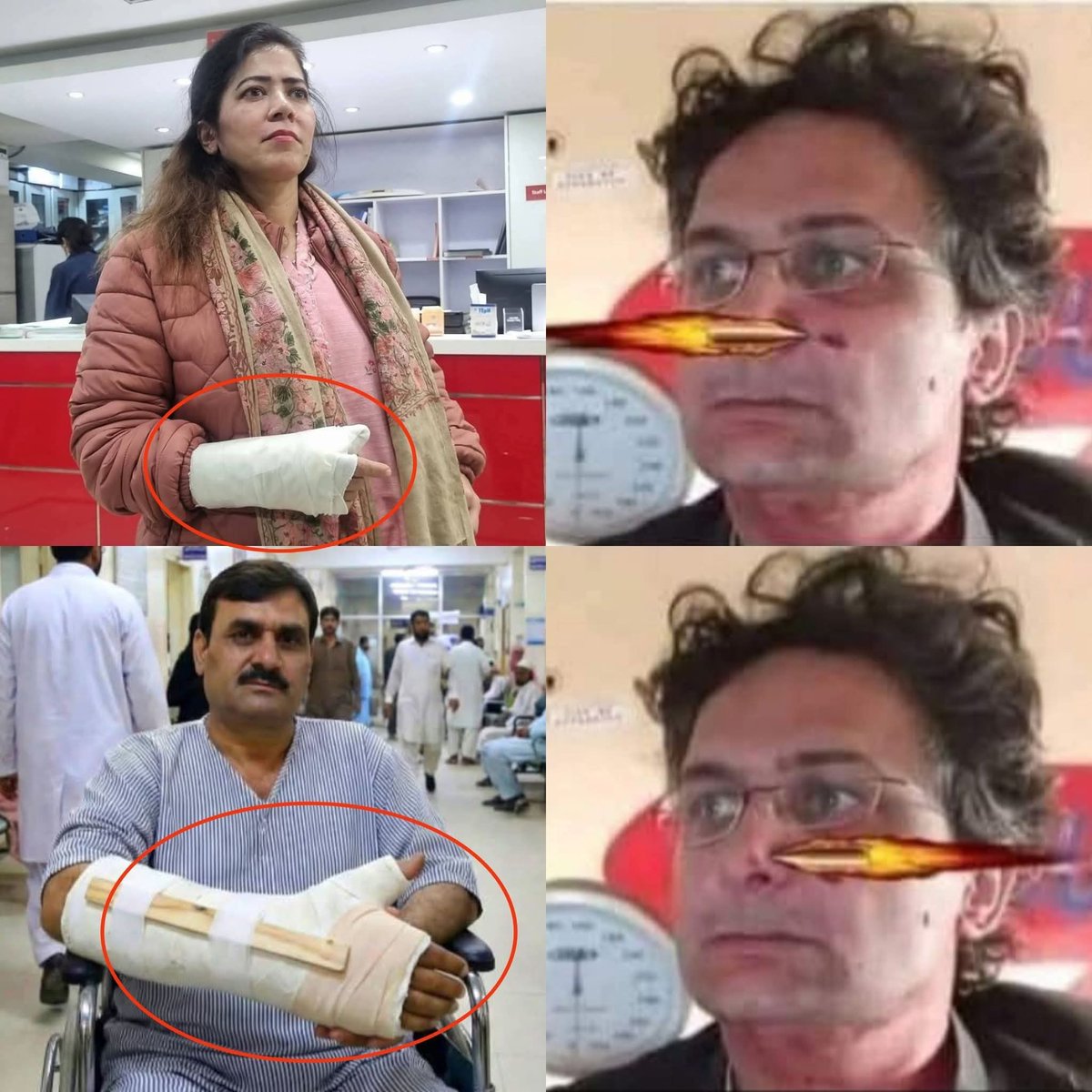 تین سال سے فیصل جاوید کا مسئلہ حل نہیں ہو رہا تھا کہ گولی ناک کو چھوئے بغیر کس طرف سے آئی اور اب یہ نیا مسئلہ کھڑا ہو گیا ہے کہ پانی سے ہاتھ ٹوٹ گیا لیکن میک اپ نہیں اترا اور انگوٹھا زخمی ہونے پر پورے بازو پر پلستر کیوں چڑھا لیا ہے 🤔