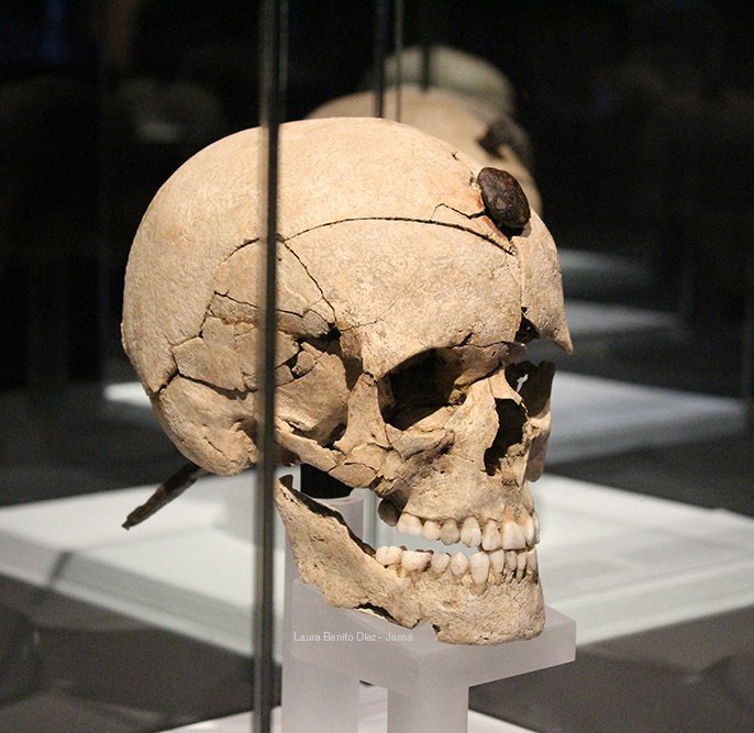 Cráneo encontrado en el poblado íbero de Ullastret (Gerona)

Porque sí, Mia, en la Edad de Bronce tenían dentaduras perfectas (fruto de la buena alimentación). No eran cromañones desaliñados y con pelos de loco