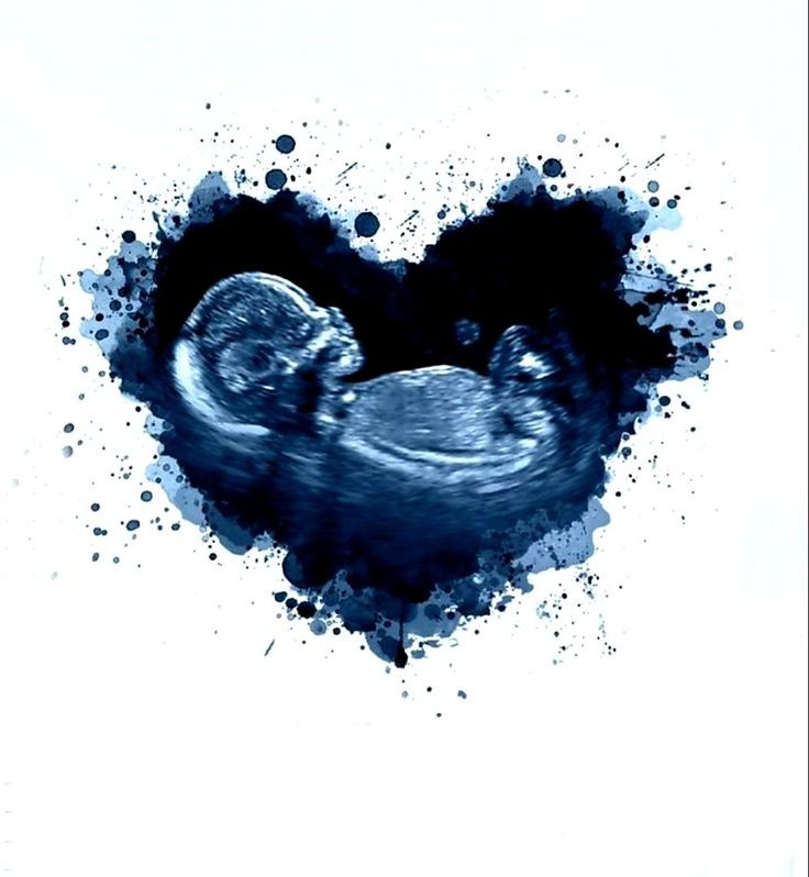 Levi_A_22's tweet image. After doing an intimate little gender-reveal under the Christmas tree by their fireplace, the Shmidt-Family is happy to announce that their little Bug is going to be a little 🩷🍼🎀GIRL🎀🍼🩷

🎀Congratulations to the
Happy Little Family of 5🎀