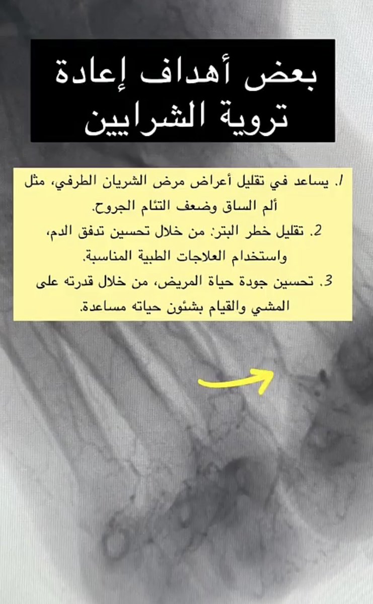 Abdulaziz AlGharras عبدالعزيز أحمد الغراس tweet media