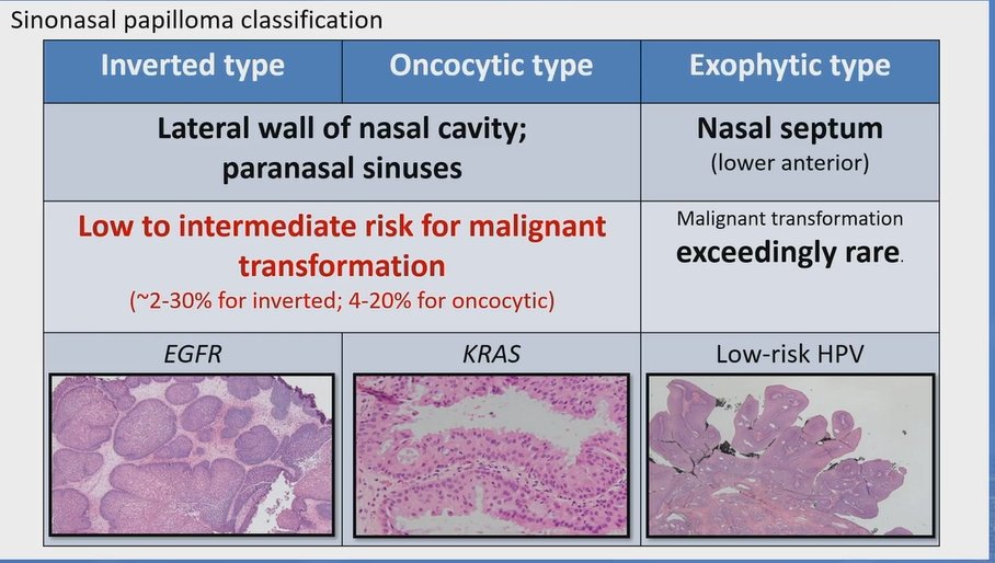 Sinonasal papilloma classification

- Inverted type
- Oncocytic type
- Exophytic type

Dr. Nishino - 2025 Diagnostic Pathologic Update #USCAP #pathology #PathX