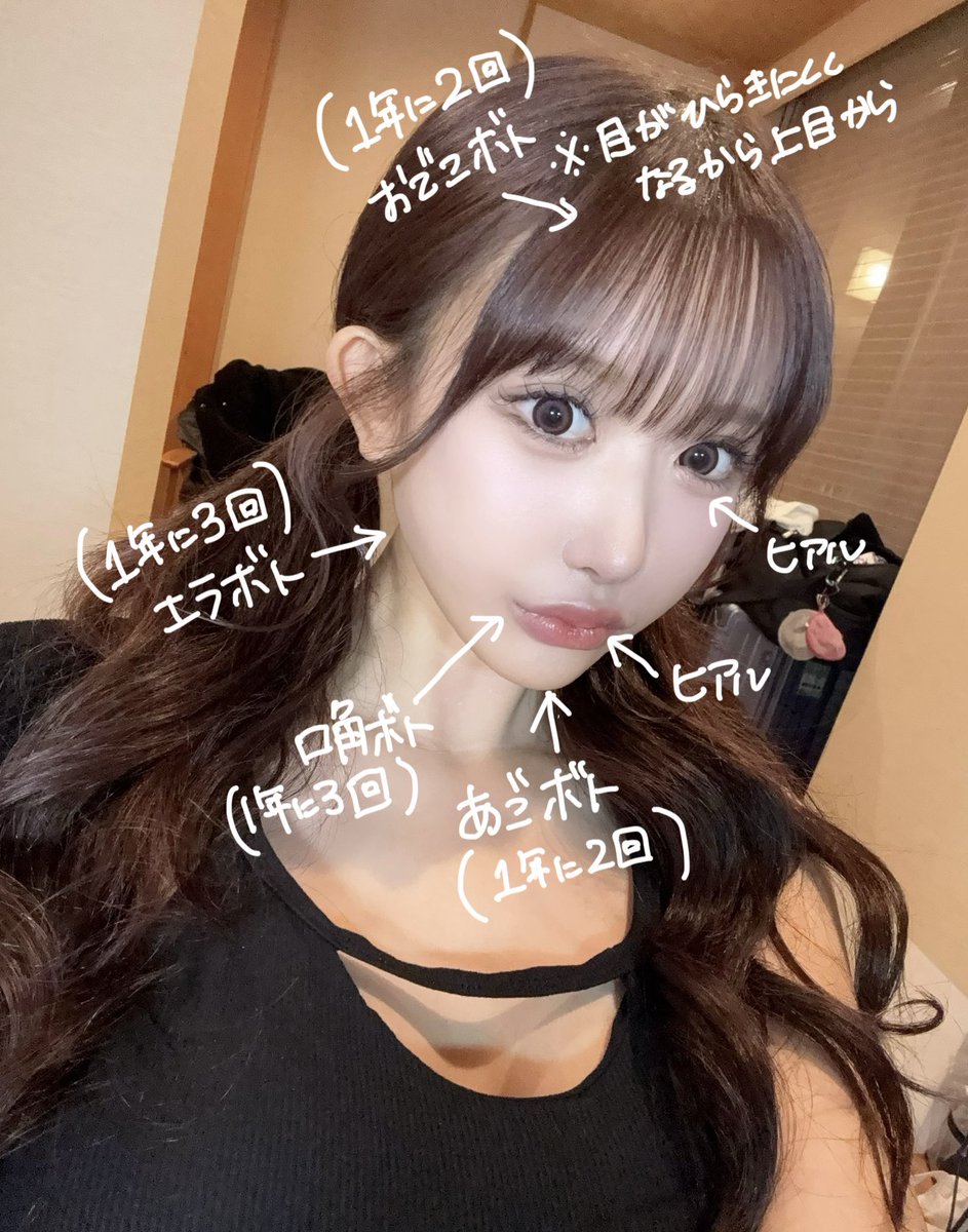 pp_m1216's tweet photo. 私のヒアル、ボトックスレシピ💉
🌟ボトックスはメンテナンス
🌟ヒアルロン酸は困った時
どっちもDT無くて簡単に出来るけどデザインと量でかなり変わるから丁寧にカウンセリングしてデザインしてくれる先生が良い🙆‍♀️あと肩ボトは本当にオススメです人生変わった https://t.co/SFhHdGZcXu