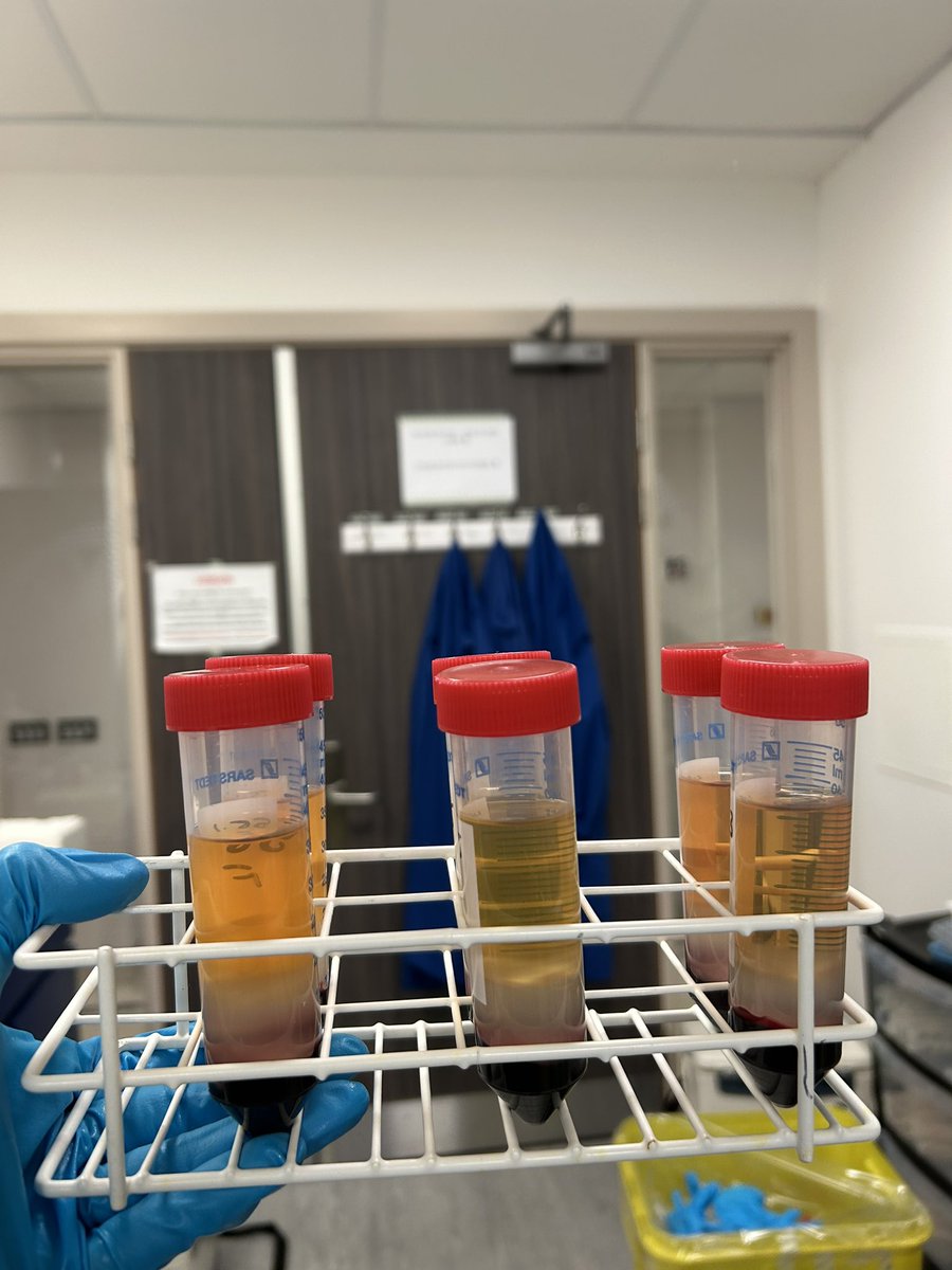 jo_ward08's tweet image. Finishing off in the lab and feeling very grateful for a fabulous year with an even better team 😍 the biggest thank you to the dream supervisors @Chillslincoln79 @psquireslincoln for the opportunities, support and laughs- you make doing a PhD the dream #womeninstem #phdchat