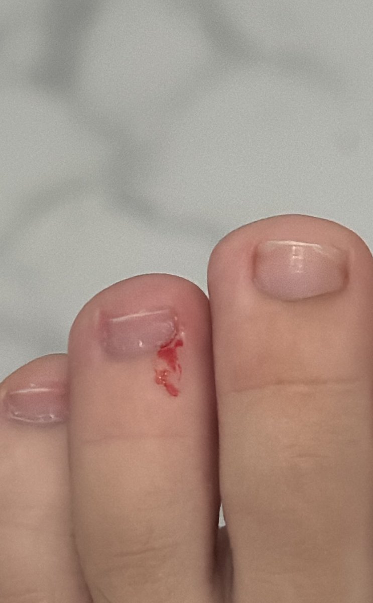 AL34here's tweet image. Sakit bgt pantek