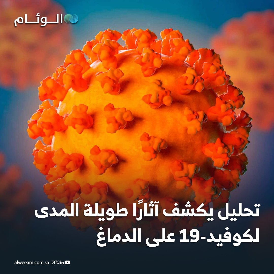 دراسة أسترالية باستخدام الرنين المغناطيسي رصدت تغييرات واضحة في أنسجة وبنية الدماغ بعد الإصابة بكوفيد-19، حتى لدى المتعافين. - التغيرات ارتبطت بضعف الذاكرة والتركيز على المدى الطويل. - النتائج تؤكد وجود آثار عصبية ممتدة للفيروس، وهو ما يتماشى مع تحذيرات منظمة الصحة العالمية. 