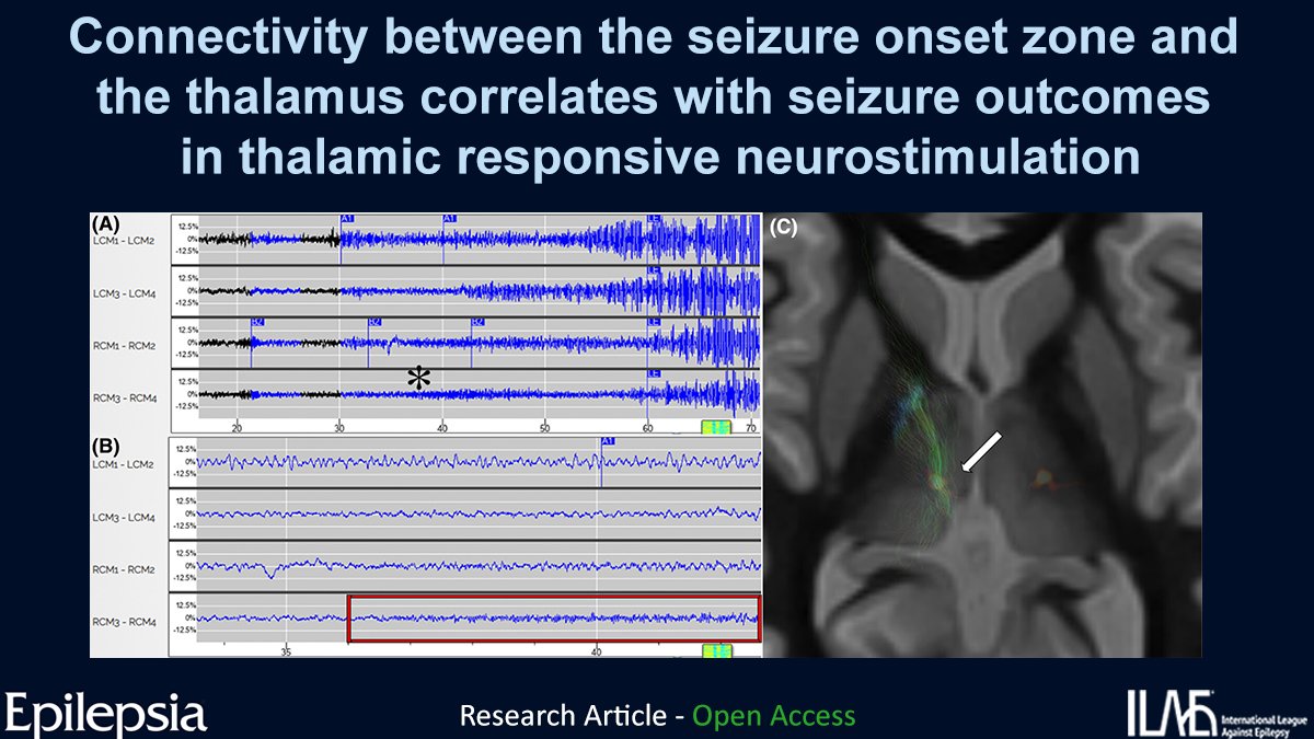 Epilepsia tweet media