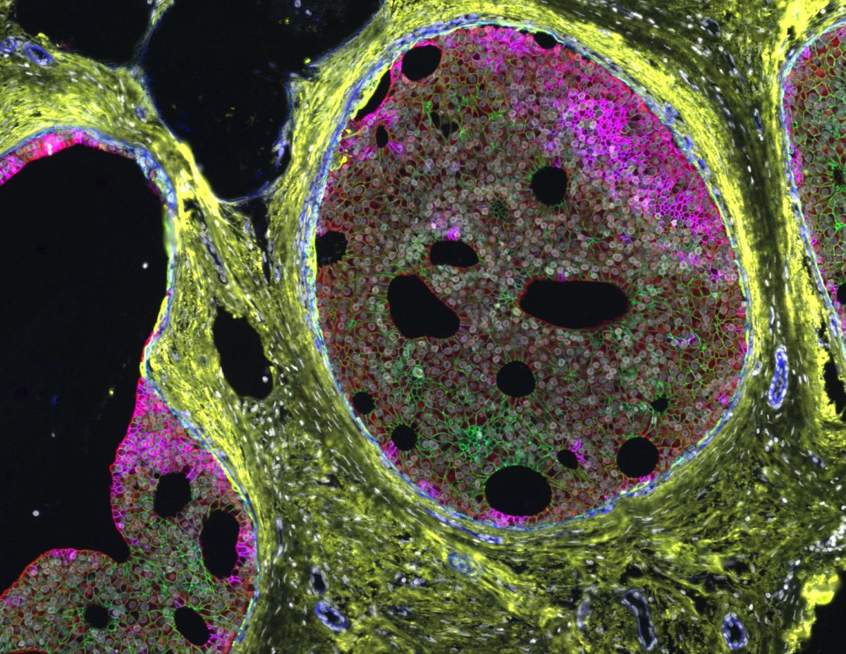 RareCyte, Inc. tweet media