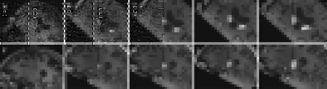 Russell Lonser, M.D. tweet media