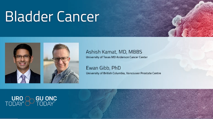 Molecular classifier studies to identify aggressive subgroup in low-grade #Bladder tumors. <a href="/ewanagibb/">Ewan Gibb</a> <a href="/VanProstateCtr/">Vancouver Prostate Centre</a> joins <a href="/UroDocAsh/">Ashish M. Kamat, MD, MBBS</a> <a href="/MDAndersonNews/">MD Anderson Cancer Center</a> to discuss the development of a molecular classifier for identifying aggressive TA low-grade #BladderCancer tumors. #WatchNow >
