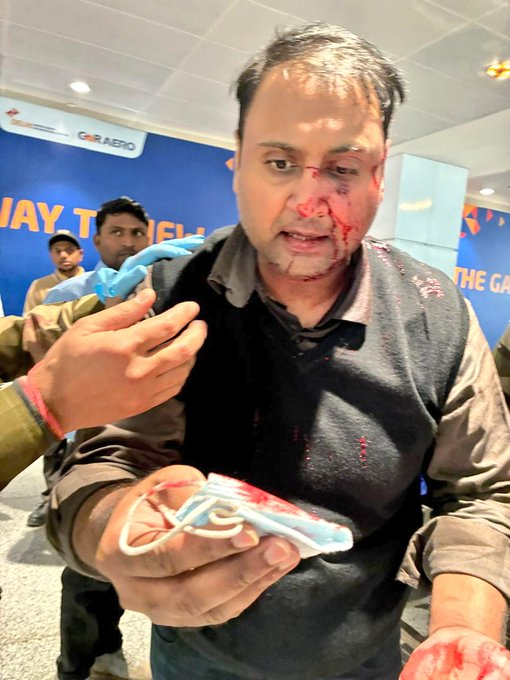 TimesNow's tweet photo. Air India Express pilot accused of assaulting passenger at Delhi airport.

(Source: Ankit Dewan/X) https://t.co/0LEEmS4AMc