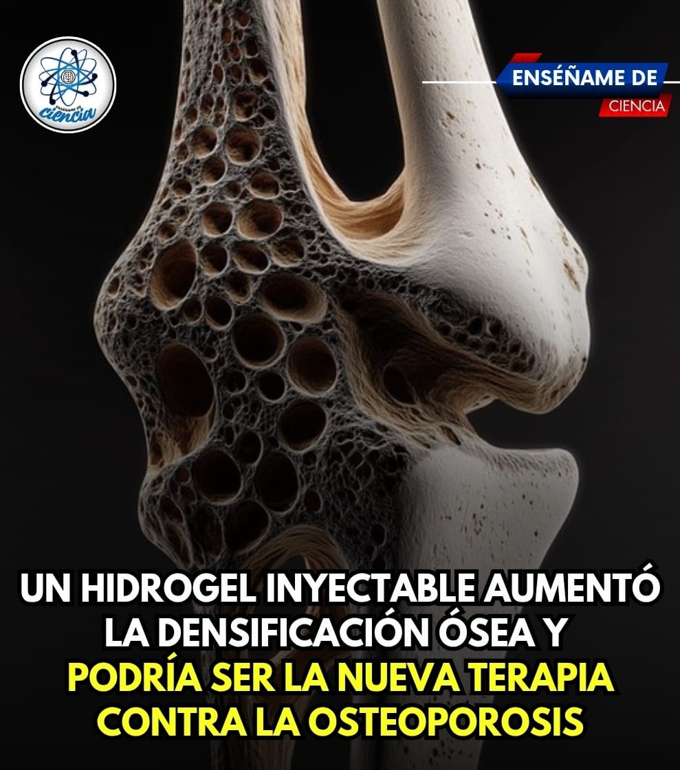 El hidrogel desarrollado está compuesto de ácido hialurónico y nanopartículas de hidroxiapatita. Así como también está diseñado para imitar los minerales naturales que componen el hueso.

En los estudios realizados se demostró que las inyecciones de hidrogel por sí solas lograron