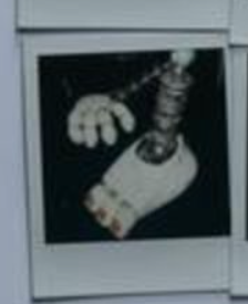 tjxz_z's tweet photo. why do they have mangles feet pics??? https://t.co/N6cfBaX27s