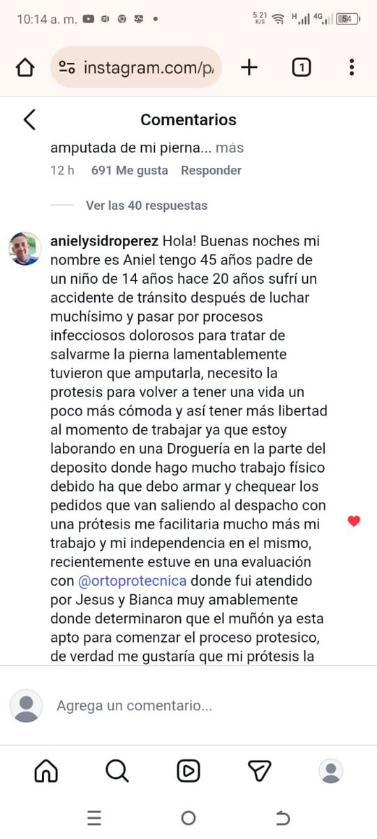 A todos mis amigos por acá, les quiero pedir un favor que me ayuden a darle me gusta a este comentario para que el señor pueda tener sus prótesis. 

Acá le voy a dejar el link del IG: instagram.com/reel/DSD09M7jo…