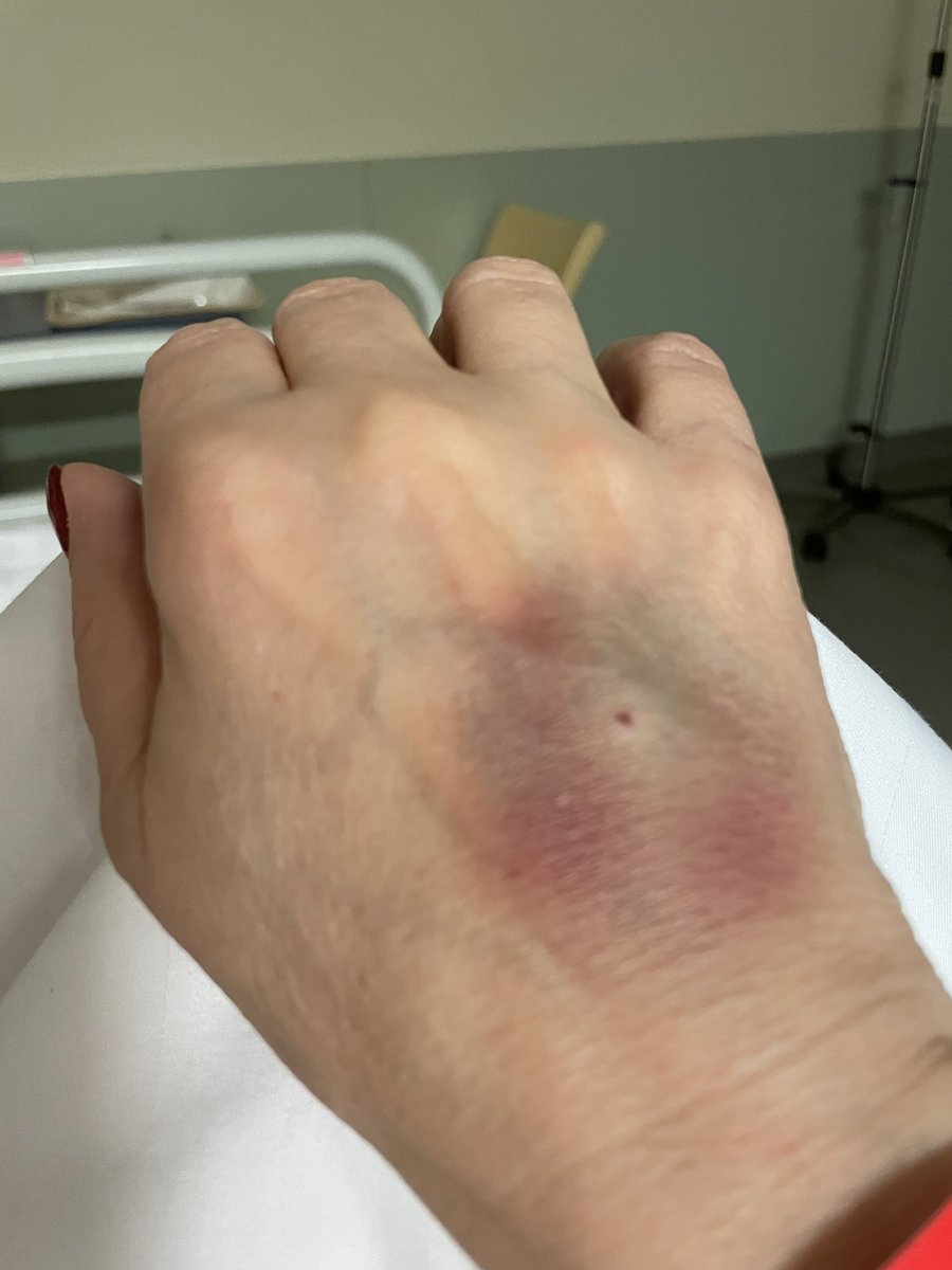 Blau, aber nicht vom Punsch