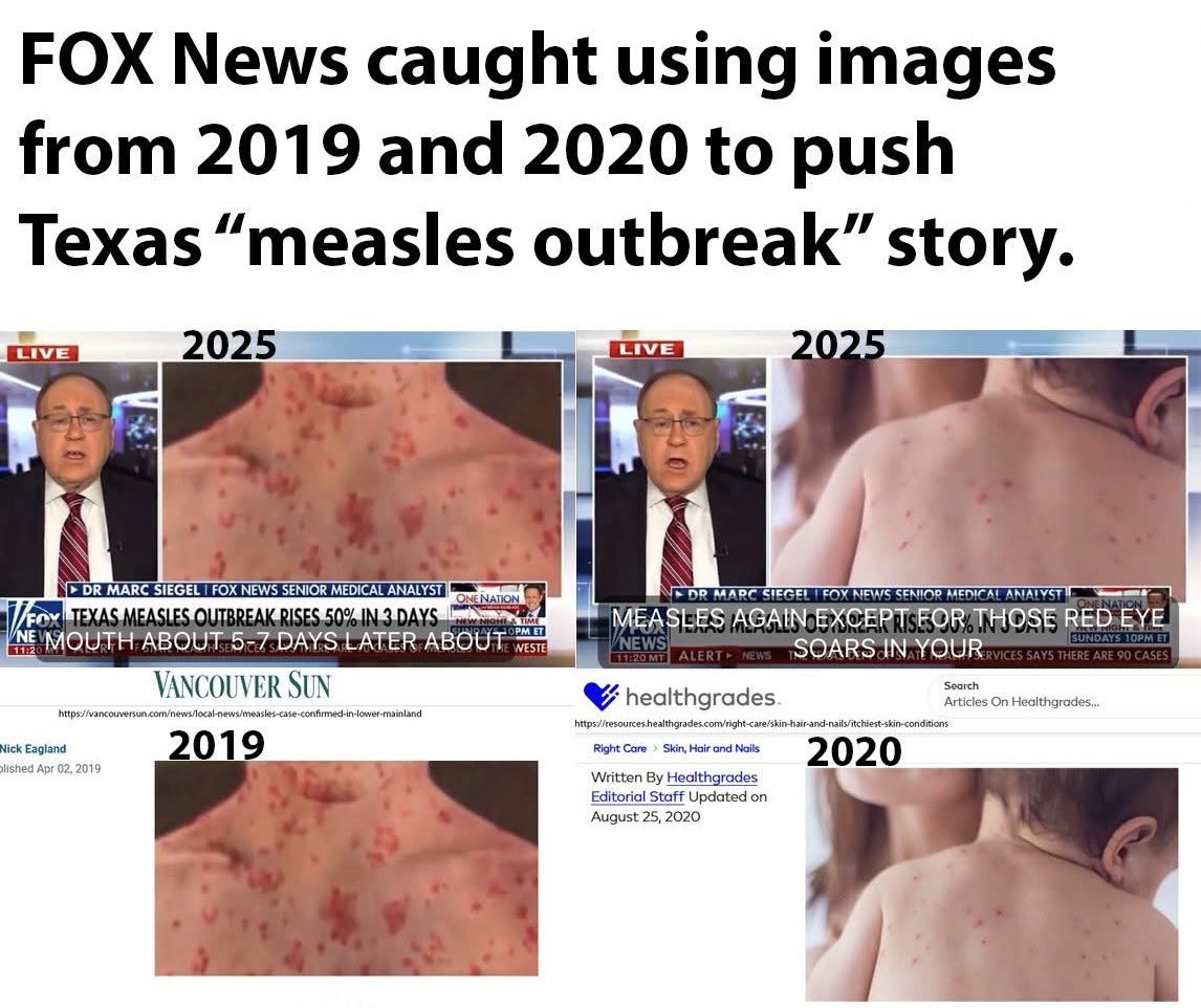 The entire vaccine industry is now depending on a "measles surge" to reclaim lost ground.

- All rashes are becoming measles 
- All deaths becoming measles deaths

It is practically a rerun of Convid.