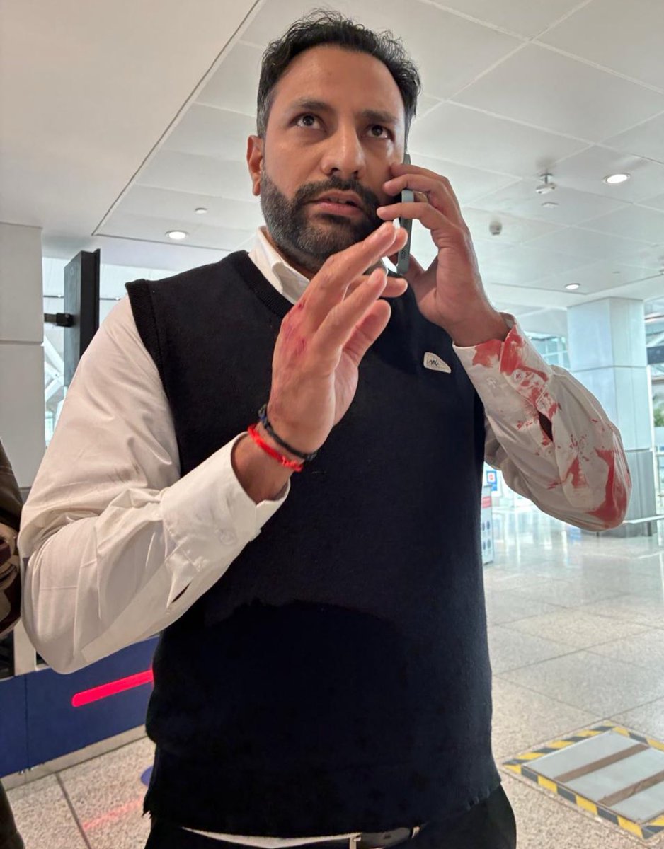 snehamordani's tweet photo. Passenger @ankitdewan attacked by a Pilot in Delhi Airport. 
We needed just this for passengers to get respite from delays and cancellations at the Delhi Airport 
Yahi bacha tha 

Plus, Imagine this is the state of mind of the pilot who could be flying your plane https://t.co/geP4TZ0C7F