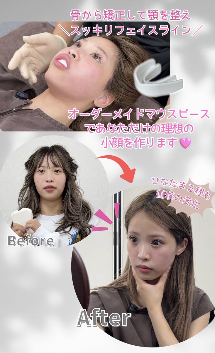 💖骨から変わる小顔へ 💖 「なんか昔と違う…歪み…たるんできた