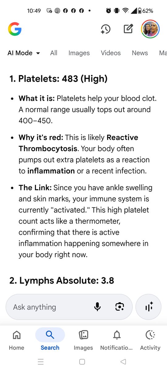 Bjsaffo's tweet photo. @NicHulscher I just got my blood results and I am so pissed 😡 my son had COVID and a week later everything flared up for me even tho never had COVID. Taking that jab was the worst mistake in my life! https://t.co/Mqs3csMw6N