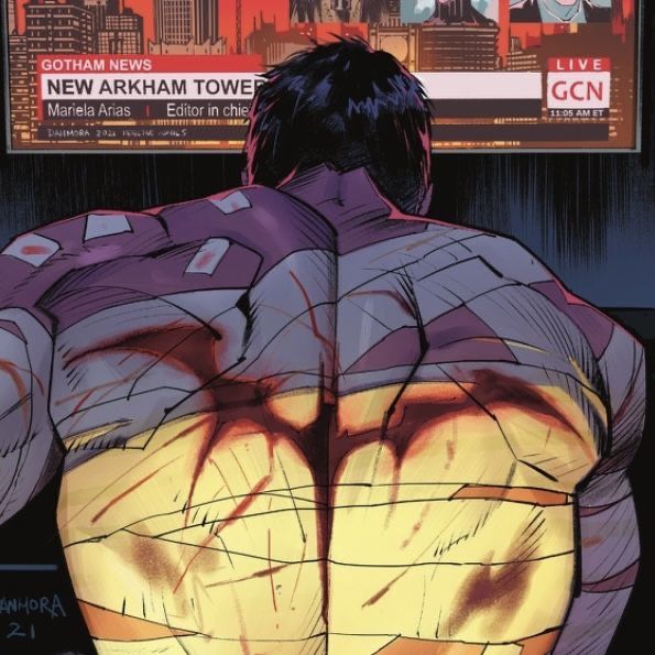 bruce’s scar forming a bat-like shape . hes just so cool