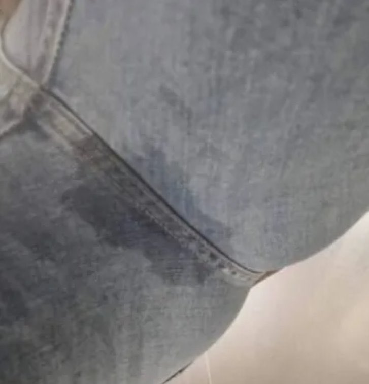 Lại bị gì rồi nè