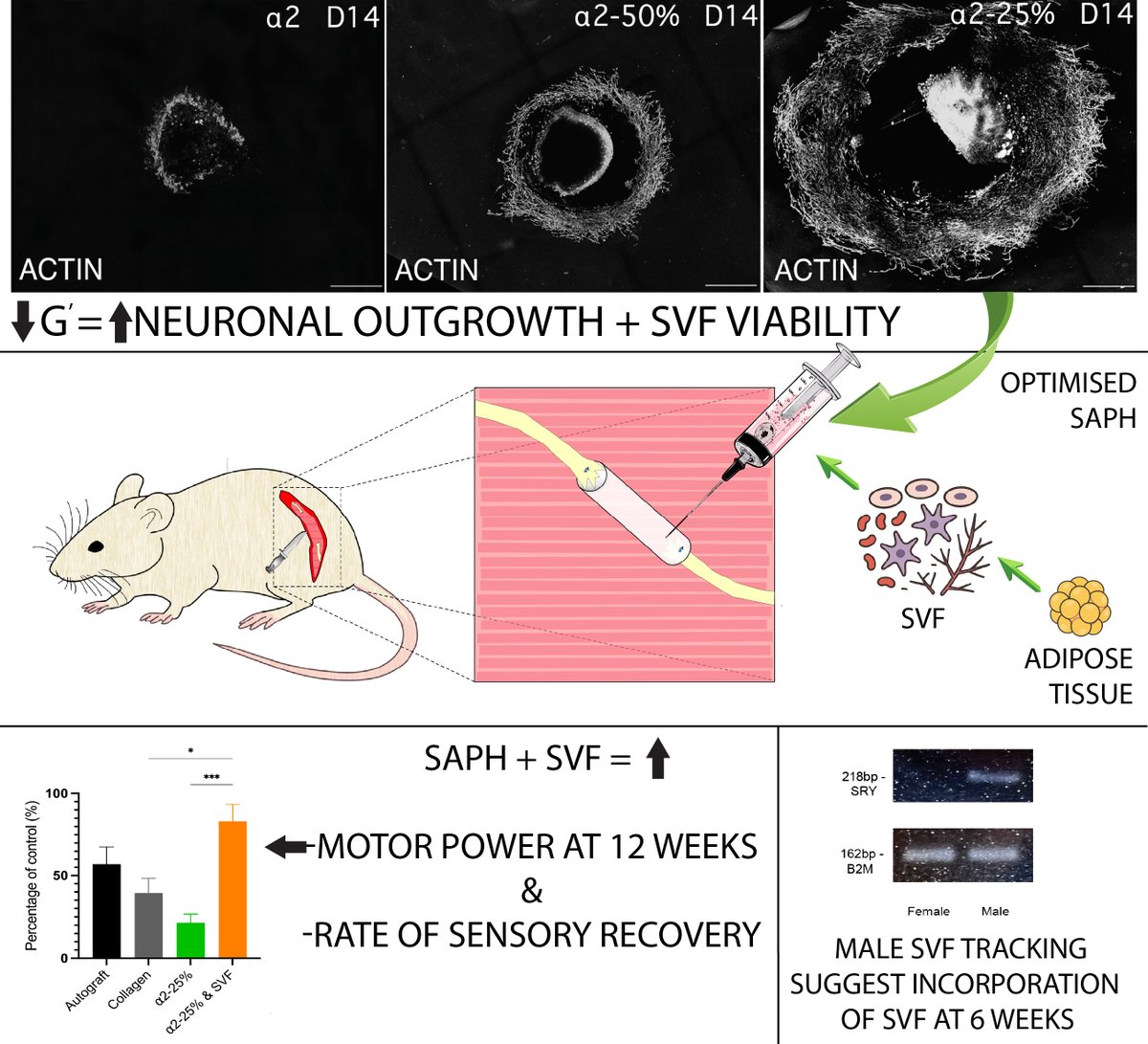 liammcmorrow's tweet image. SVF is a regenerative cell isolate from FAT tissue 🍰

Using a novel #biomaterial, we (@UoM_BMLabs) delivered #SVF into an injured #nerve💉

📰 The cells incorporate into the nerve and improve recovery.   

⬇️
doi.org/10.1002/adhm.2…

Funders @UKRMP_Smart @BAPRASvoice @BSSHand