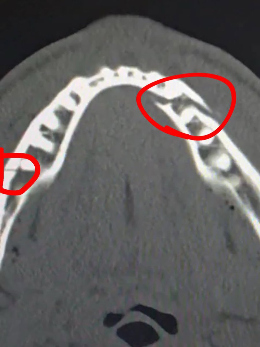 Home of Fight tweet media