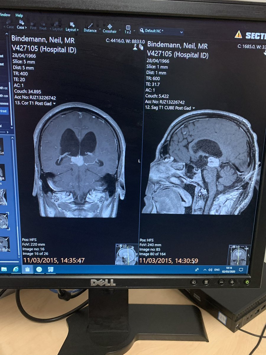 Neil Bindemann tweet media