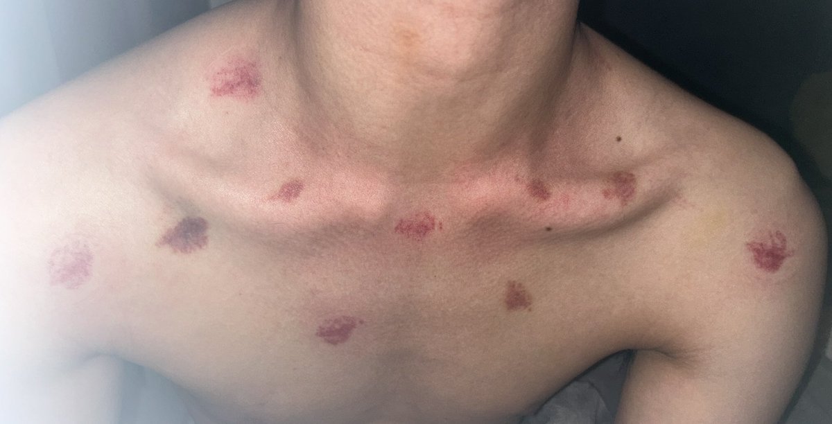 ♡⃛₊⁺˖158˖⁺₊♡⃛ tweet media