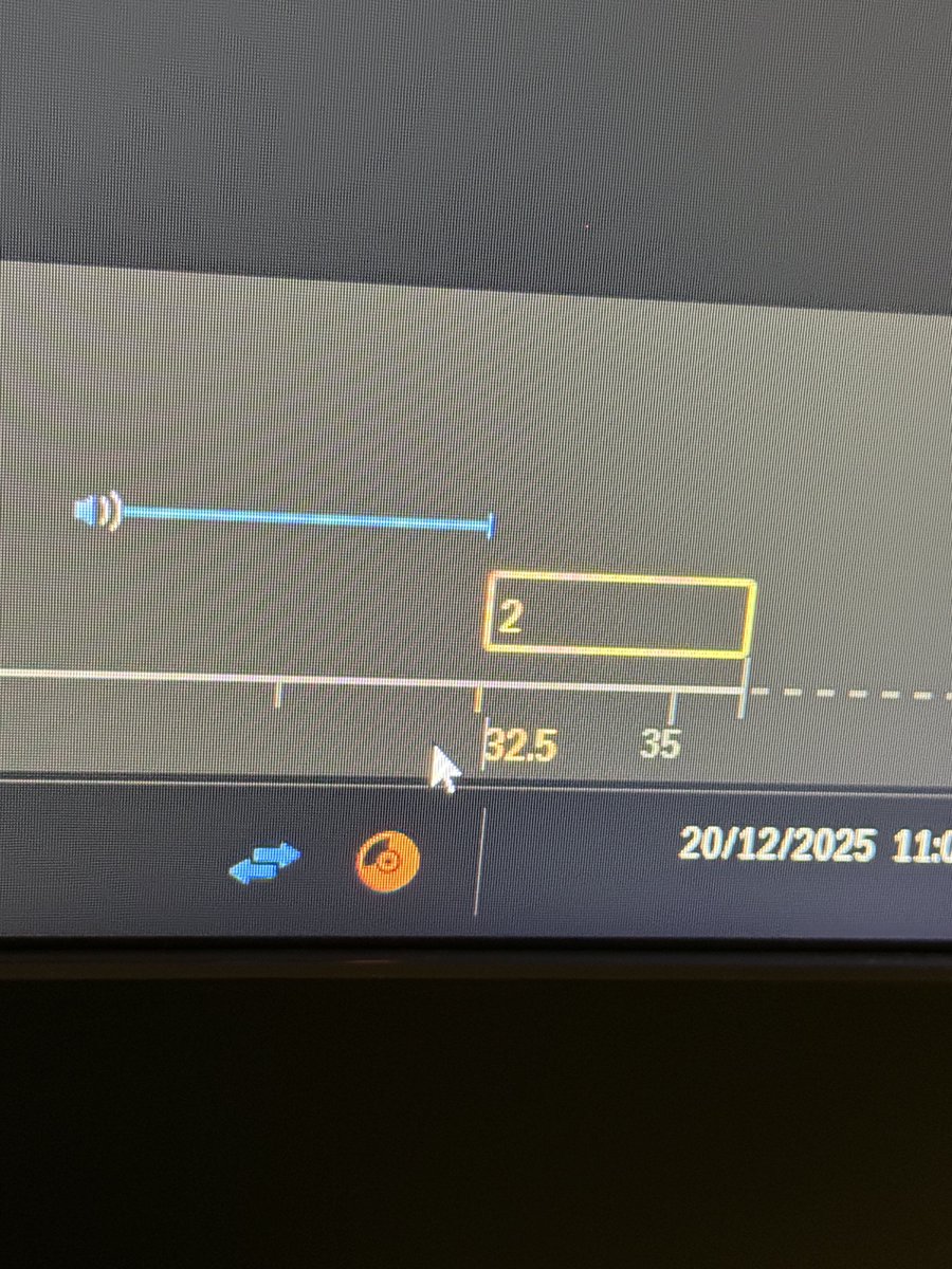 chehraaaa's tweet image. Doc : Vous me faites un temps mixte entre 30-35s ça va le faire 

Moi : d’accord pas de soucis 

Encore moi :