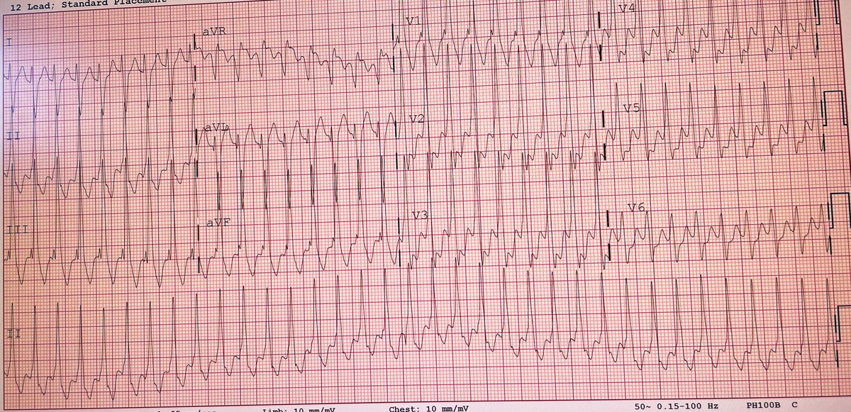 Asanka Migelheva tweet media