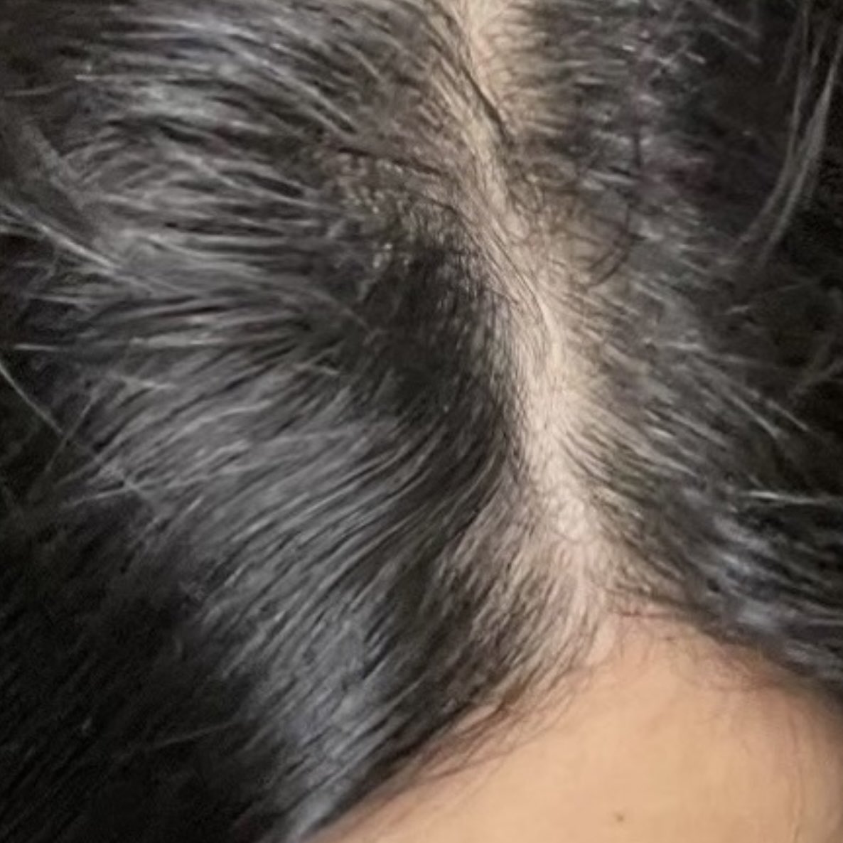 4amvanila's tweet image. ไม่พูดเยอะ คือผมที่หายไป มันขึ้นมาใหม่ แล้วยาวเร็วด้วย ใช้ไป 2 ขวด แชมพูโสมในตำนานอะ ดีมาก ผมไม่มันเร็ว ไม่แข็ง 👀🫶🏻