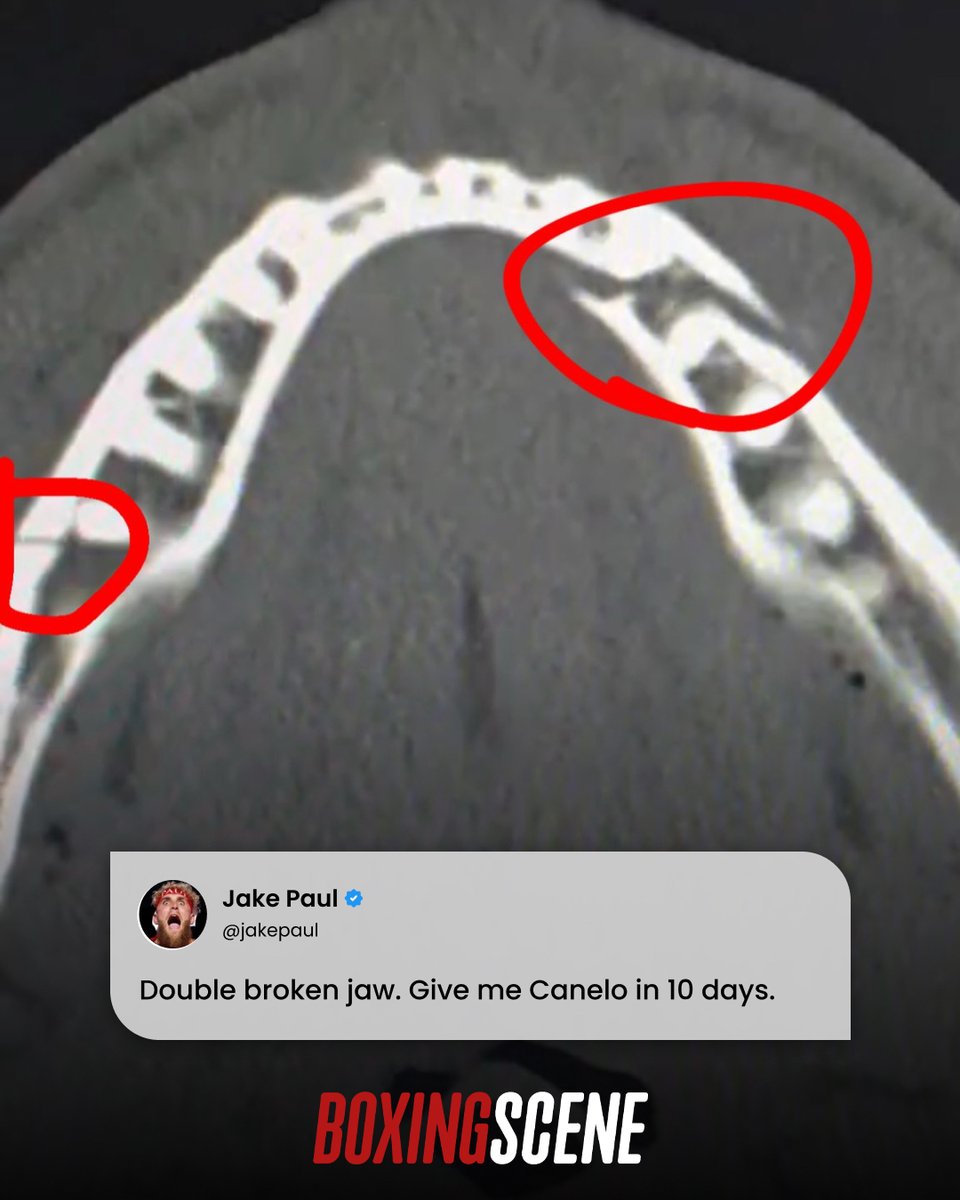 BoxingScene.com tweet media