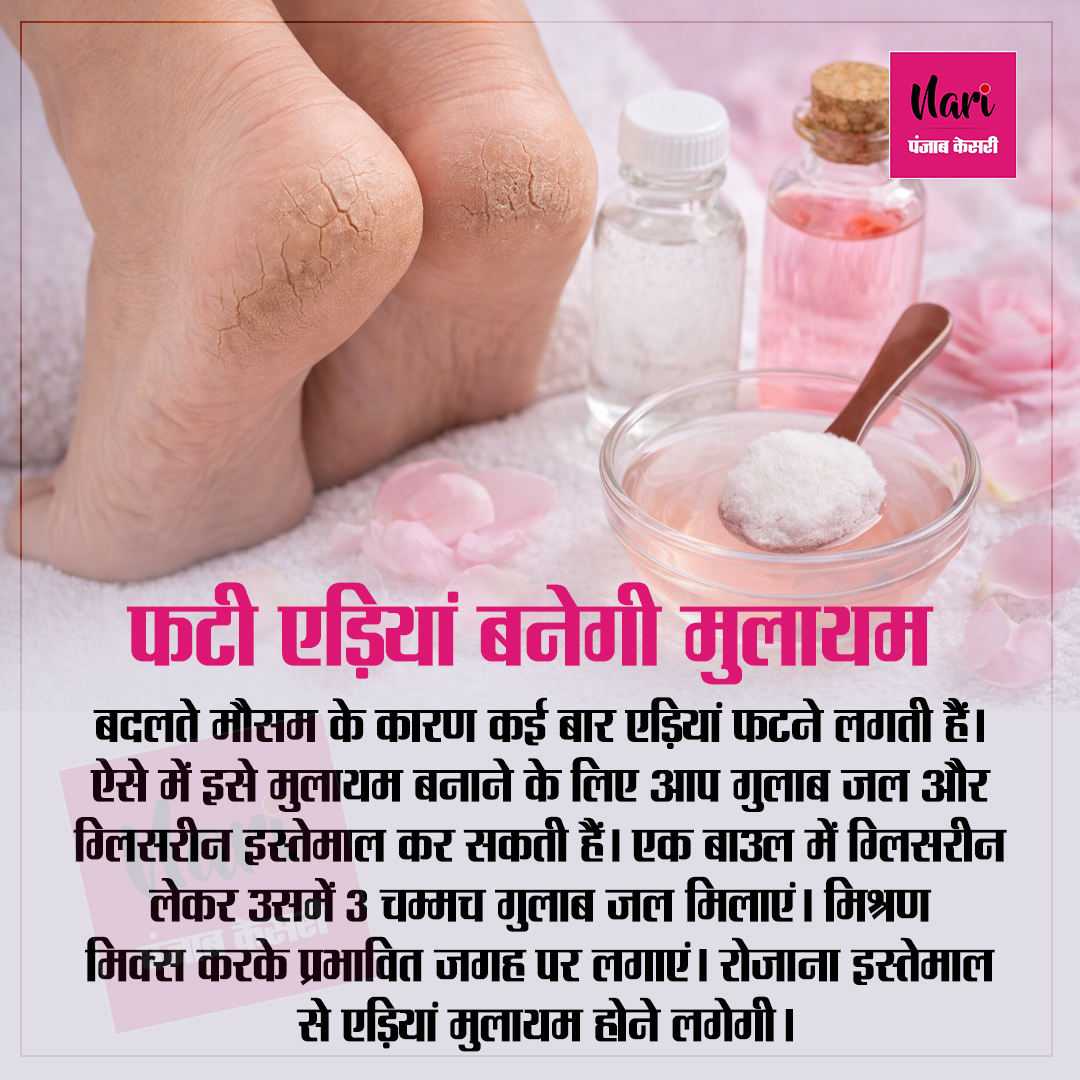 NariKesari's tweet image. फटी एडिय़ां बनेगी मुलायम

#CrackedHeels #FootCare #dryheels #homeremedy #health #beauty