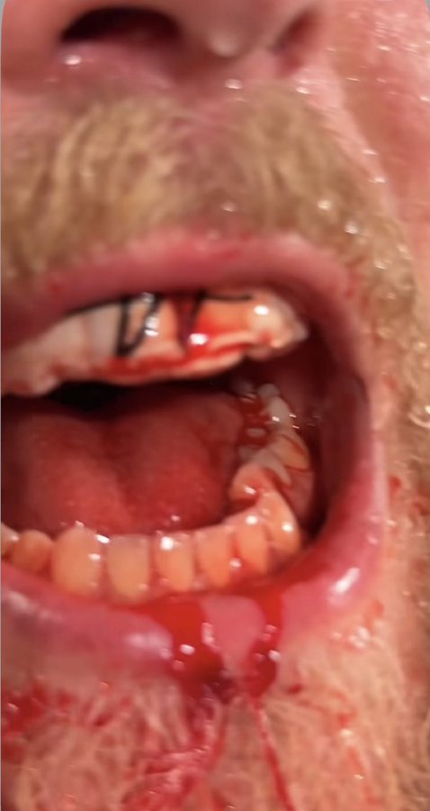 Patrick Savalle tweet media