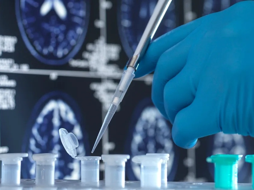 أبحاث جديدة تمهّد الطريق لعلاج اضطرابات الشيخوخة. علماء: توصلنا لبروتين بالدم يعيد للنشاط لـ #الخلايا_الجذعية 