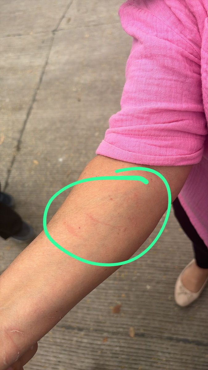 BertrandKilvett's tweet image. La alianza de Liberales y Libres está equivocada. Hemos sido pacientes y tolerantes ante los ataques de sus líderes. Tengan mucho cuidado con cruzar la línea con nuestra gente en los escrutinios especiales; violentan la ley electoral y han golpeado a nuestra gente. No se olviden…