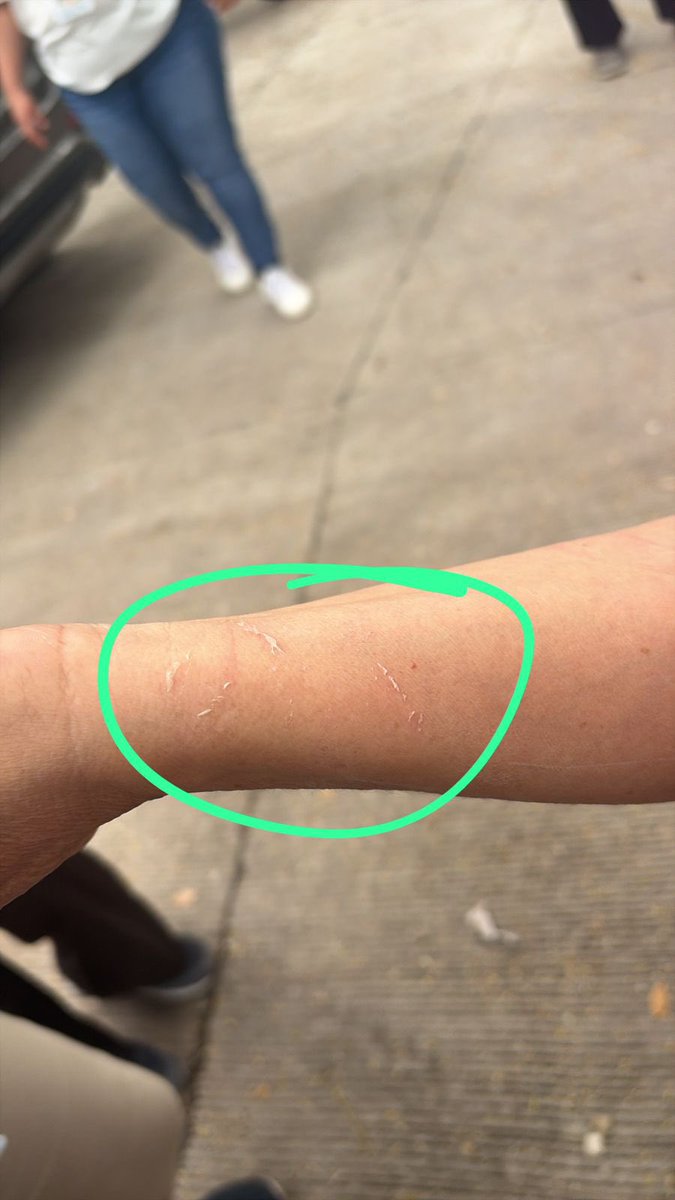 BertrandKilvett's tweet image. La alianza de Liberales y Libres está equivocada. Hemos sido pacientes y tolerantes ante los ataques de sus líderes. Tengan mucho cuidado con cruzar la línea con nuestra gente en los escrutinios especiales; violentan la ley electoral y han golpeado a nuestra gente. No se olviden…