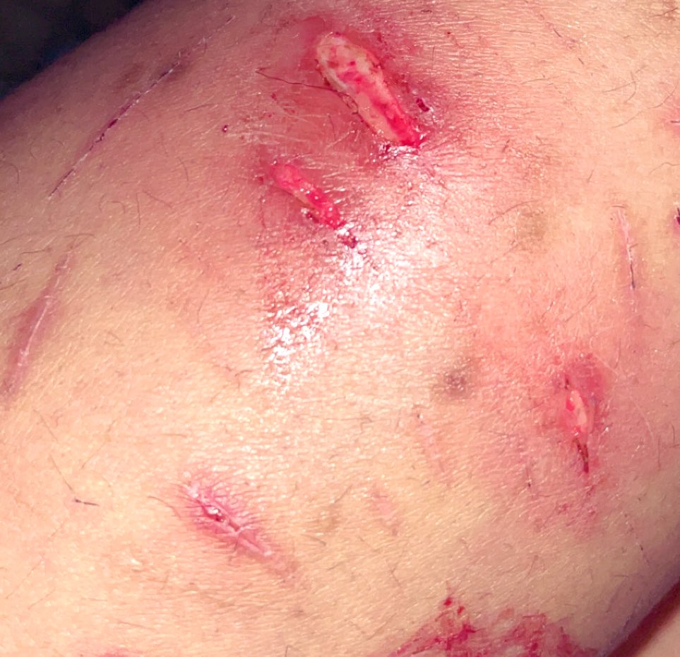 pillfilled's tweet image. I'm so sorry I feel so guilty. 

(Multiswiped in a old cut.) 
-🐈‍⬛⸝꙳.˖