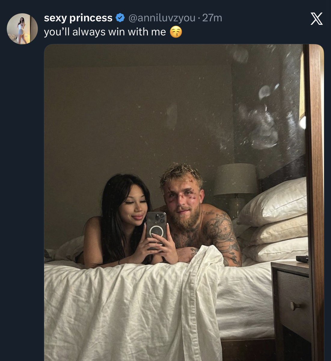 so this is why this mf lost 😭😭