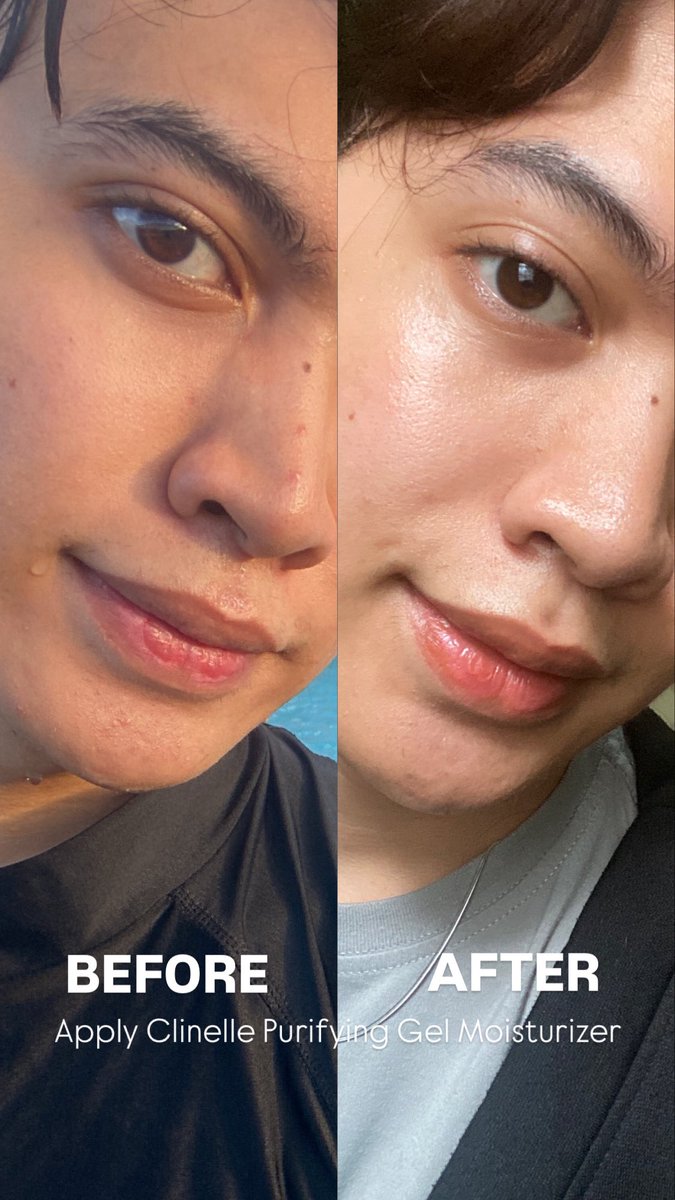 matchabuddy's tweet photo. suka banget sama moist ini karena teksturnya super ringan gabikin muka oily skin makin kek kilang minyak 🤭😭

gacuman itu …
formulasi 8x anti blemish &amp; acne actions bikin jerawat kempes, ilangin bekas jerawat, kontrol sebum, sampe halusin tekstur muka wow 🤩

nih buktinya 👇👇 https://t.co/2e0QcQCskN