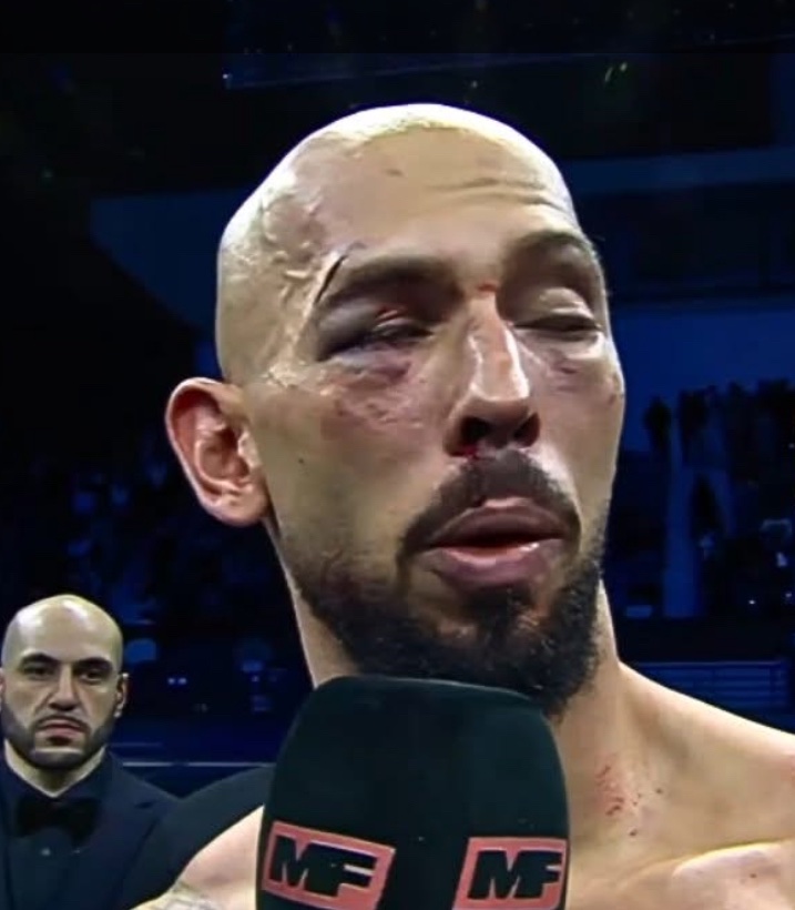 Quadcarl's tweet image. At least Andrew Tate didn’t have his jaw broken like Jake Paul. Mainly because he doesn’t have one.