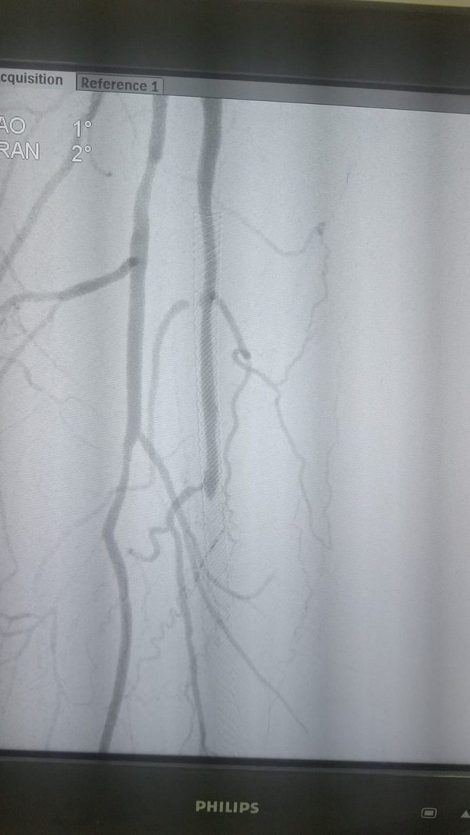 Ashutosh pandey tweet media