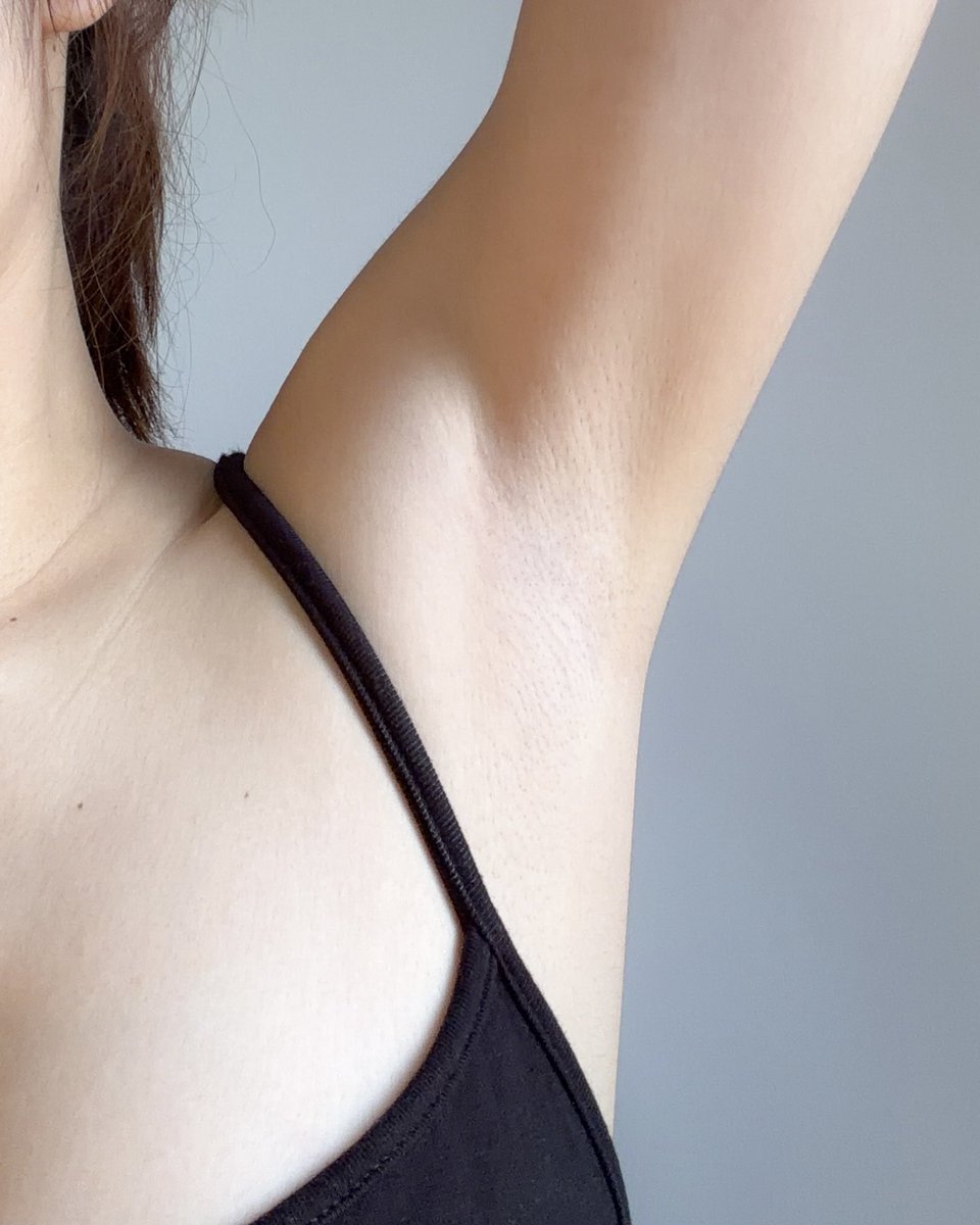 ใช้ตั้งแต่หลอดเก่ายันหลอดใหม่ ครีมทารักแร้แลปนิคคือดีมากกกก เพิ่มความมั่นใจกับรักแร้สุดๆ ช่วยแก้ปัญหารักแร้ดำคล้ำ ให้ดูกระจ่างใสขึ้น และยังช่วยเติมความชุ่มชื้นแบบไม่เหนอะ ลดกลิ่น ลดเหงื่อ ไม่ทำให้เสื้อเป็นคราบด้วยนะ