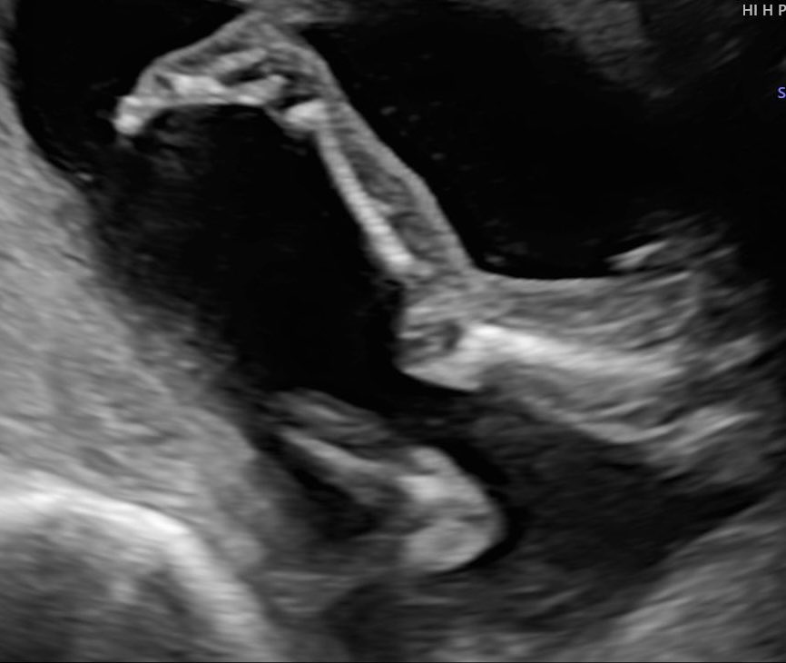 caitywaity6's tweet image. I might be making a supermodel, look at those legs!