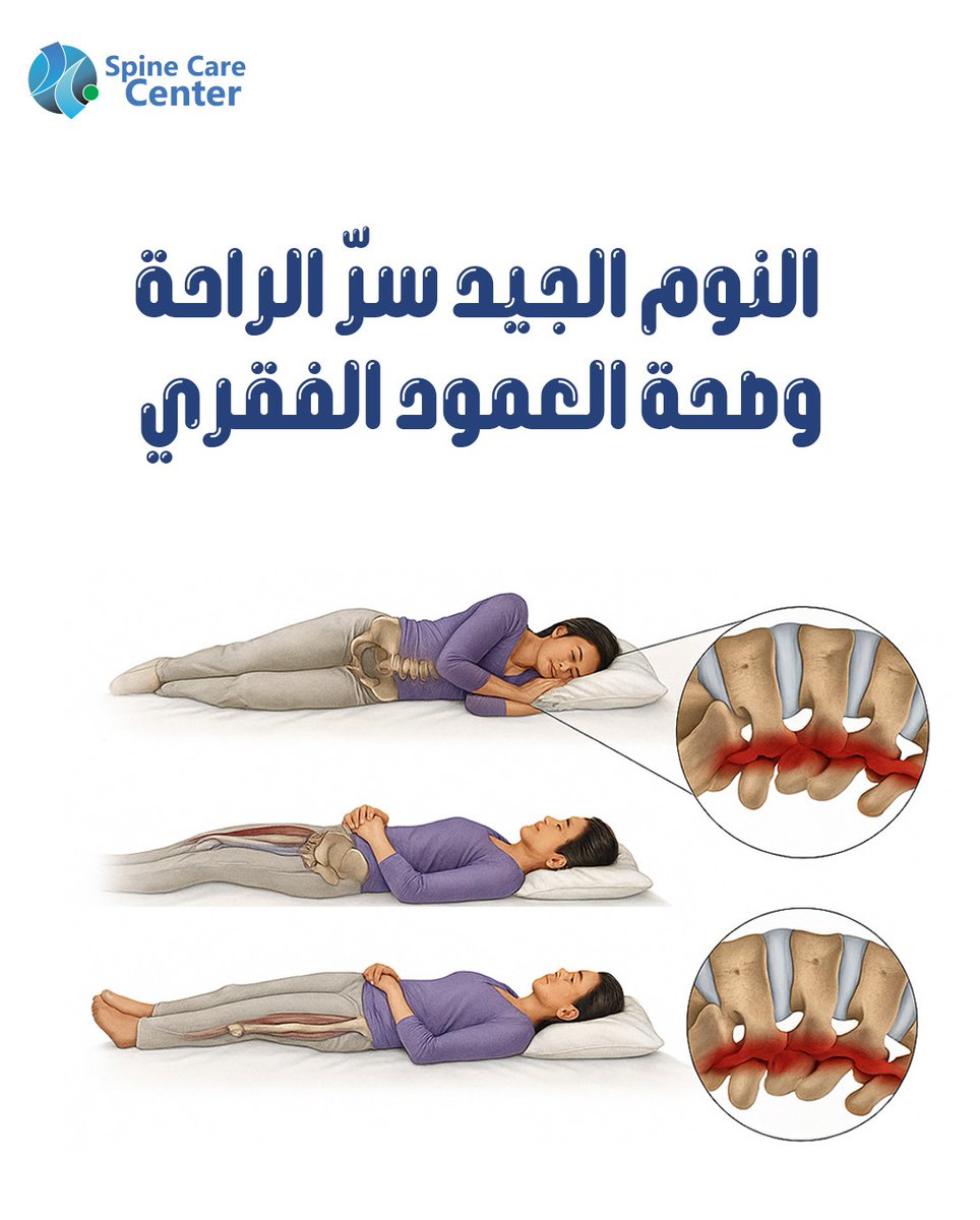 basemhenri's tweet photo. تصحى من النوم وتقول: "ليش جسمي مكسر؟" 😩💤
 مو شرط من التعب… أحياناً من وضعية نومك!
 نومك يا يشحنك ⚡ يا يستنزفك 🪫
 في الثريد الجاي 🔥:
 كل وضعية نوم وش تسوي في جسمك من الراس للقدمين 👇🏼🧠🦴
#نوم_صحي #آلام_الظهر https://t.co/xiVgRHK9Op