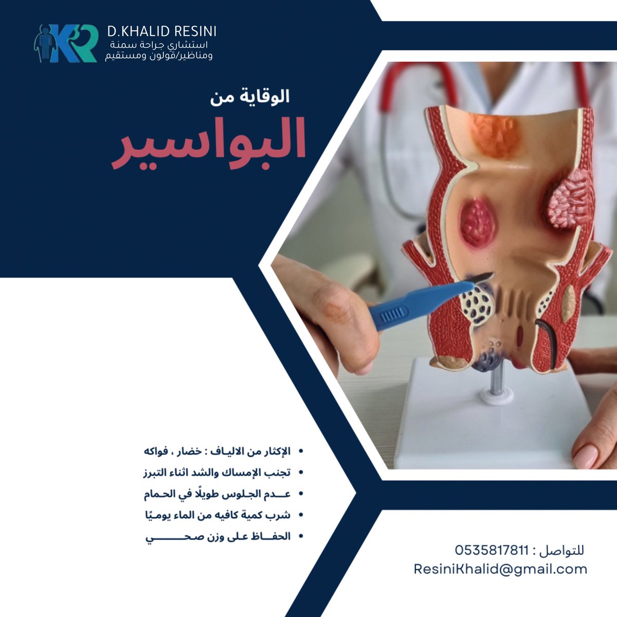 الوقاية من البواسيـر